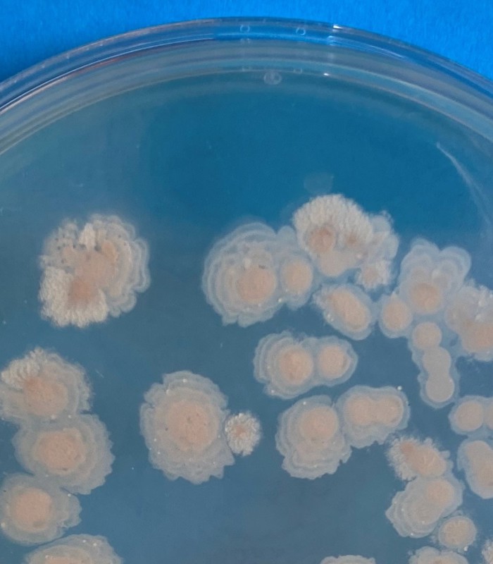 Microbiële contaminanten