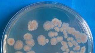Microbiële contaminanten